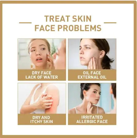 Rice Face Toner - Hydrating & Moisturizing - The Snow Owls